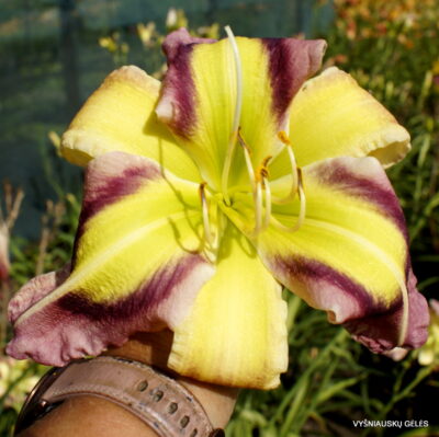 Igor F. Palacios, M.D (2)